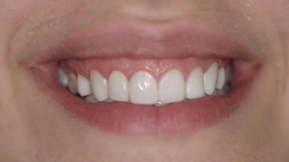 Diagnostic Treatment Services — 38 Smiles Dental Laboratory